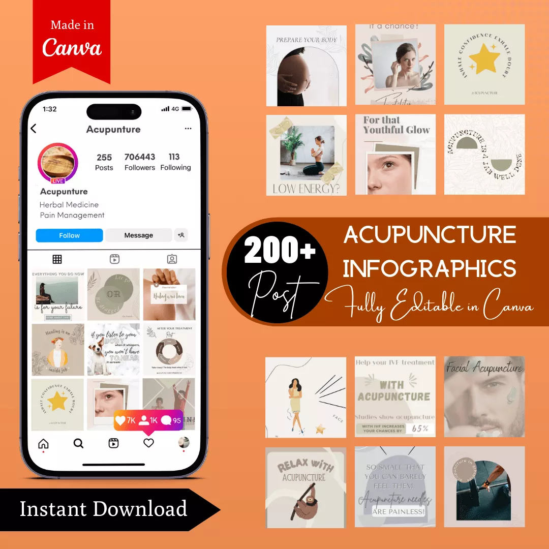 Acupuncture Infographic Ready to Post Canva Editable Templates